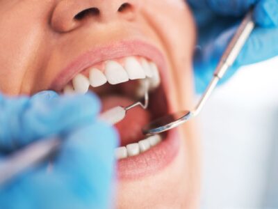 Dónde estudiar odontología en USA